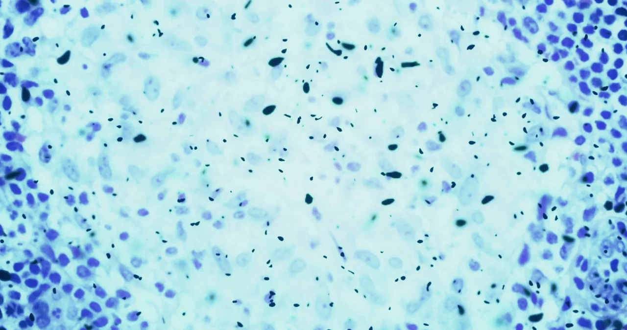 Toolbox Talk - Bloodborne Pathogens
